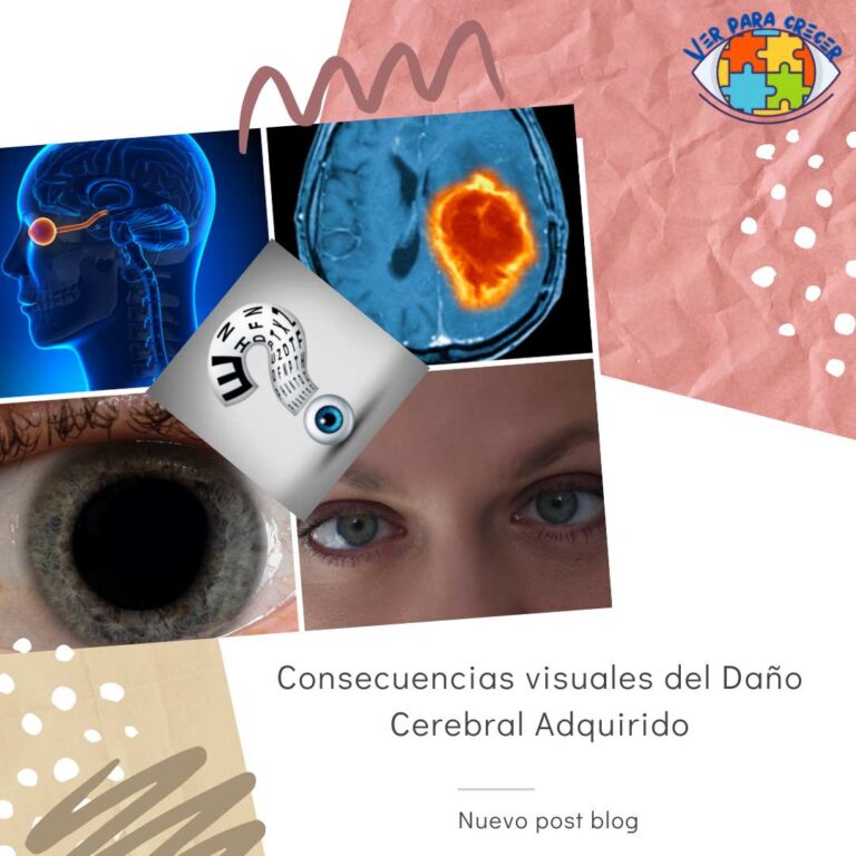 Consecuencias visuales del daño cerebral adquirido